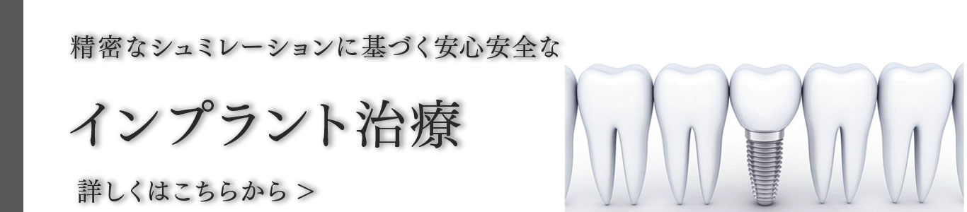 シミュレーションを基にした高度なインプラント治療