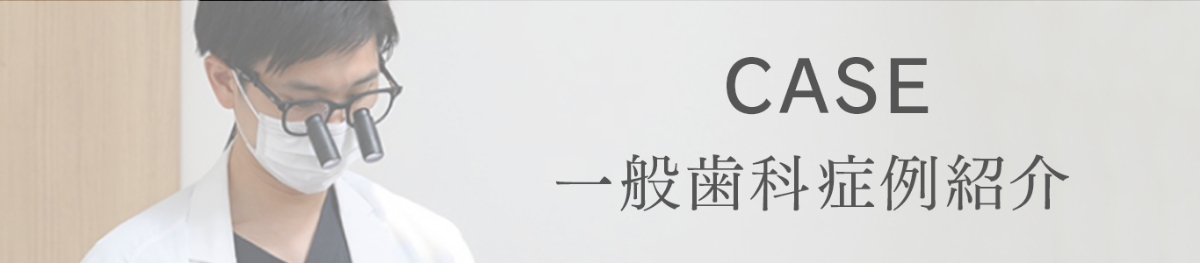 一般歯科症例紹介